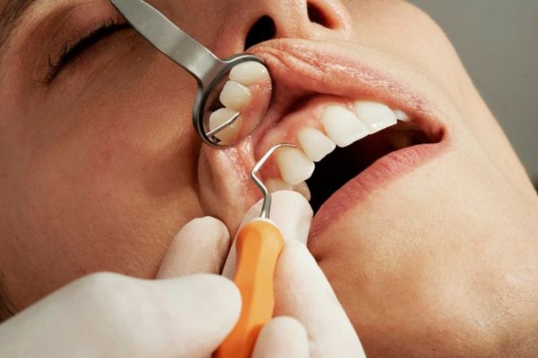 Dental Cleaning in Thornhill