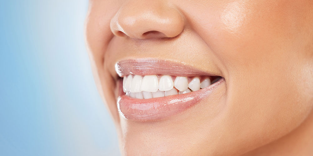 Fluoride Treatment Thornhill