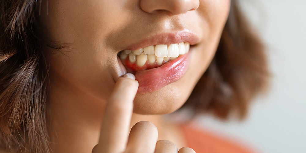 Periodontal Therapy Thornhill