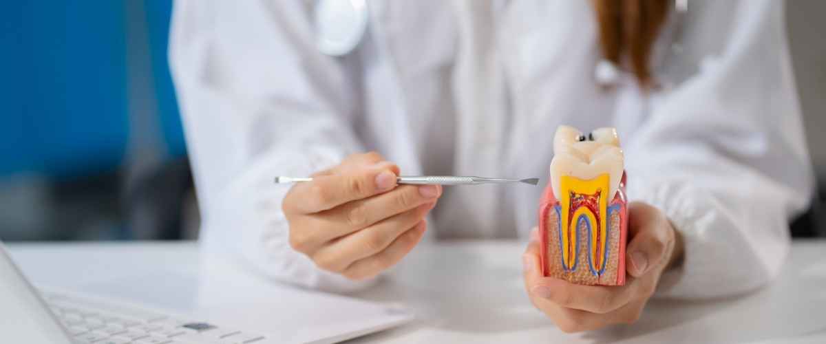 Root Canal Therapy: Saving Your Natural Tooth Without the Pain